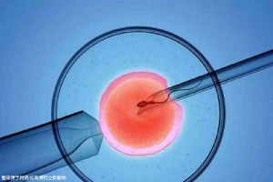 正规同性代孕咨询包生儿子